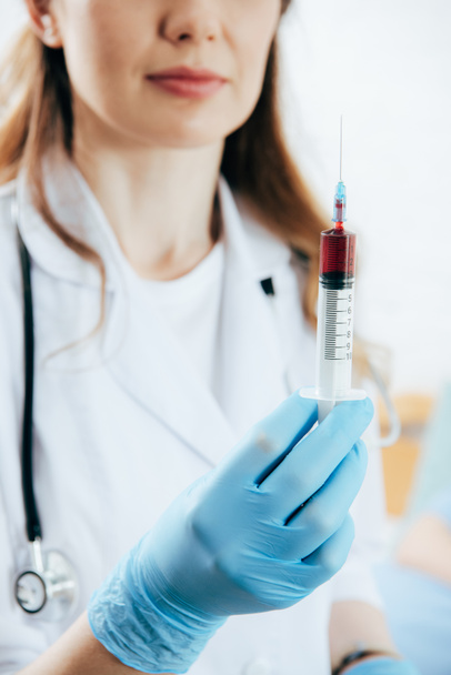 partial view of doctor in white coat holding syringe with blood sample - Photo, Image