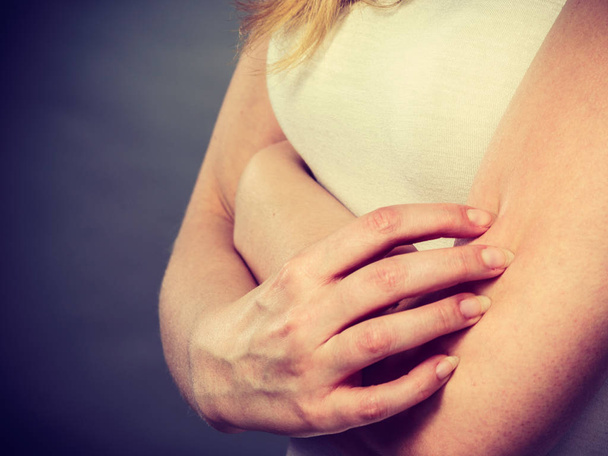 Frau kratzt sich mit allergischem Ausschlag am juckenden Arm - Foto, Bild