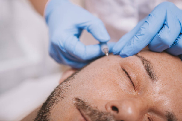 Mature man getting facial filler injections - Фото, изображение