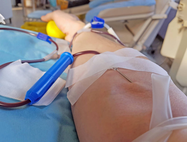 brazo de voluntario durante la donación de sangre en la cama de un médico
 - Foto, Imagen