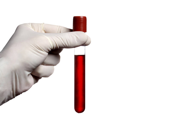 mano con guante sosteniendo un tubo de análisis de sangre aislado sobre fondo blanco con ruta de recorte y espacio de copia para su texto
 - Foto, Imagen