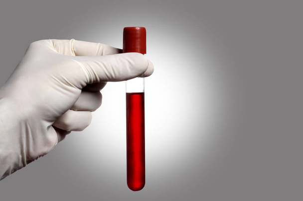 gri arka plan üzerinde bir kan testi tüpü tutan eldiven ile el ve metin için kopya alanı - Fotoğraf, Görsel
