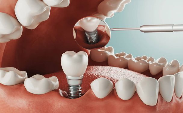 Zahnpflege, moderne Klinik, 3D-Darstellung - Foto, Bild