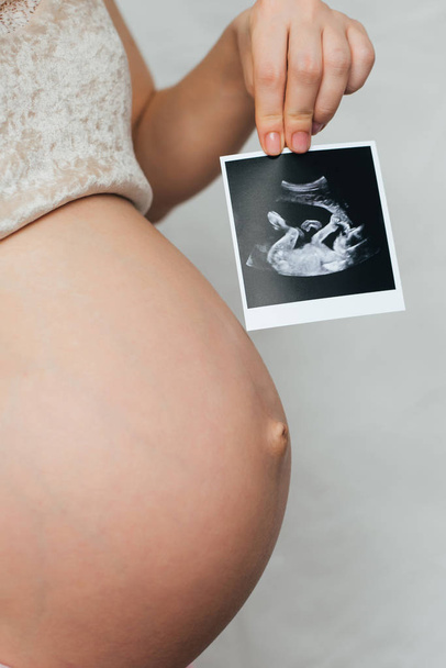 kuva raskaana olevasta ultraäänestä raskaana olevan tytön käsissä
 - Valokuva, kuva