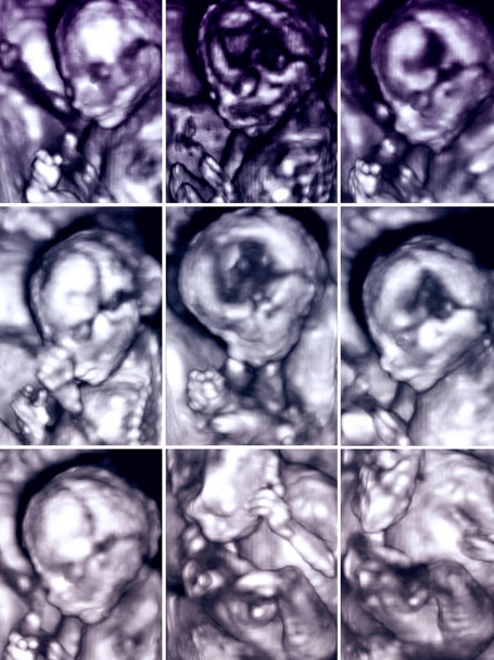 Serie von neun 3D-Ultraschallbildern des Fötus - Foto, Bild