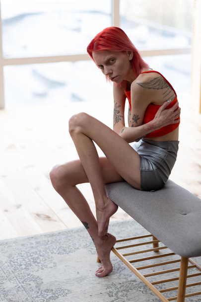 Woman suffering from bulimia sitting near window - Valokuva, kuva