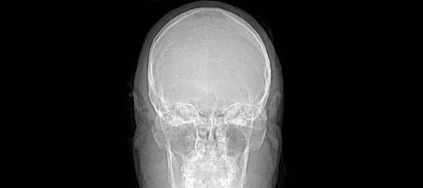 Zdravá tkáň obrazu magnetického rezonance (MRI) v mozku - Fotografie, Obrázek