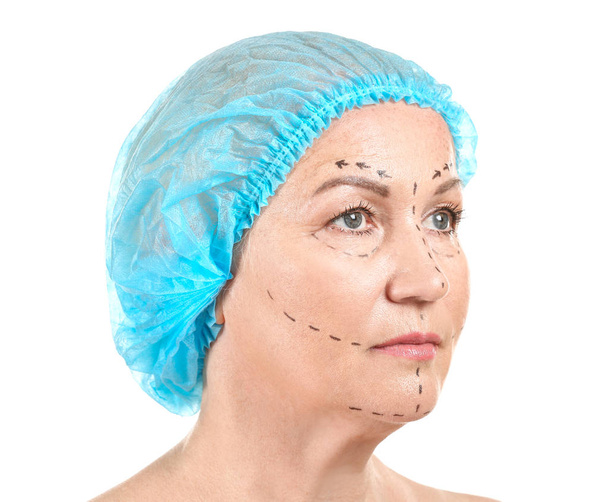 Kypsä nainen, jolla on jälkiä kasvoissa valkoista taustaa vasten. Käsitys plastiikkakirurgia
 - Valokuva, kuva