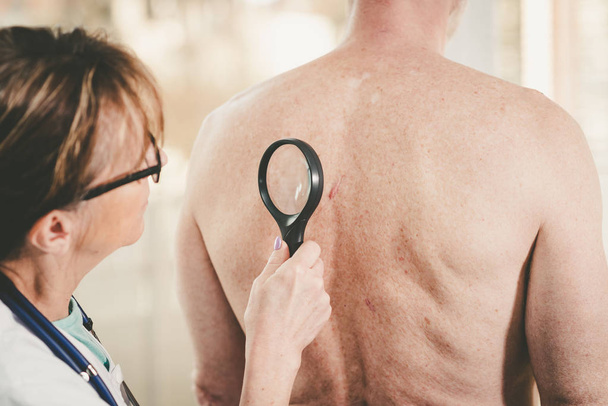 dermatólogo examinando la piel de un paciente
 - Foto, Imagen