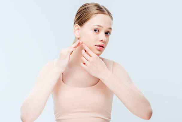 displeased teenage girl having acne on cheek isolated on grey - Photo, Image