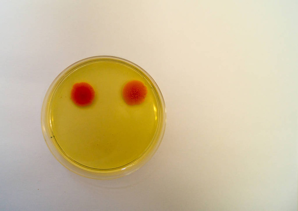 Mold grown on a Sabouraud agar medium in a Petri dish - Photo, Image