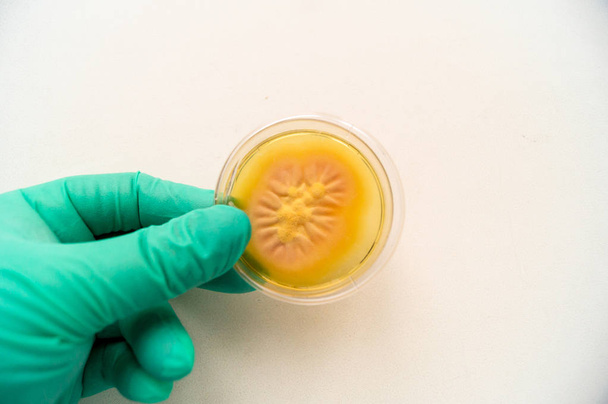 Mold grown on a Sabouraud agar medium in a Petri dish - Fotografie, Obrázek