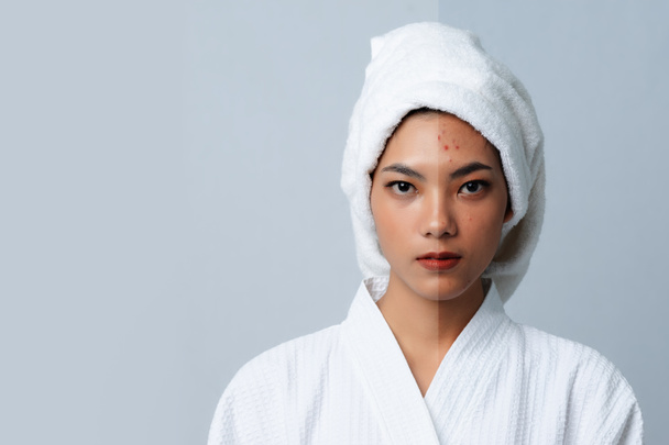美しいアジアの女性の比較肖像画。ダークスポットと新しい肌、前 - スキンケアとクリーンなコンセプトの後、若返りのための老化の美容治療プロセス. - 写真・画像