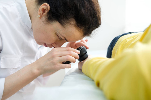 Θηλυκό δερματολόγο που χρησιμοποιεί ένα επαγγελματικό δερματοσκόπιο ενώ κάνει εξέταση του δέρματος, ελέγχοντας καλοήθεις κρεατοελιές στο χέρι. Δερματολόγος που εξετάζει σημάδια γέννησης και κρεατοελιές σε μια γυναίκα ασθενή. Δερματολογία κλινική - Φωτογραφία, εικόνα