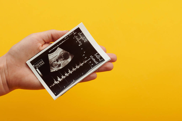 Scansione a ultrasuoni
 - Foto, immagini