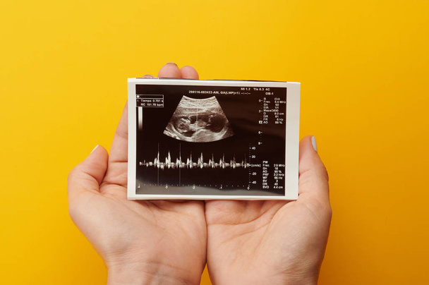 Vrouw houden ultrasone foto - Foto, afbeelding