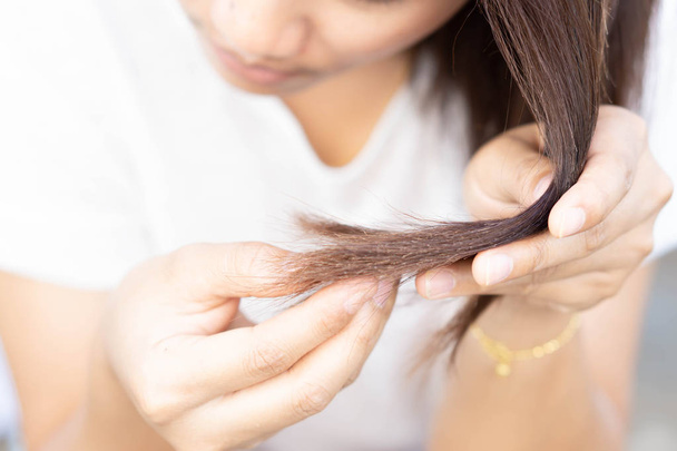 Nainen vakava hiustenlähtö ongelma terveydenhuollon shampoo ja kauneus tuotteen käsite
 - Valokuva, kuva