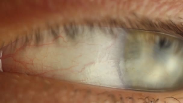 блимає чоловіче око крупним планом озираючись. Червона артерія на макросі очного яблука. реакція учня на світло. Міоз і мідріаз. закриття та відкриття повіку - Кадри, відео