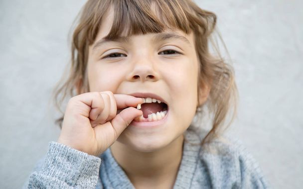The kid had a baby tooth. Selective focus. - Foto, Imagen