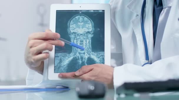 Портативний знімок рук лікаря, що вказує на сканування рентгенівського променя мозку
 - Кадри, відео