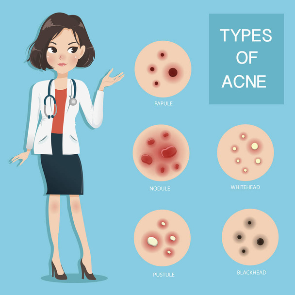 doctors recommend typ of acne. - Vector, Image