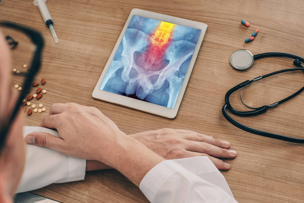 Arts kijken naar een digitale tablet met x-ray van de heupen met pijn in de wervelkolom - Foto, afbeelding