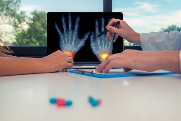 医師は、女性患者にラップトップ上の手首に痛みを伴う手のX線を示す。机の上の錠剤変形性関節症の概念 - 写真・画像