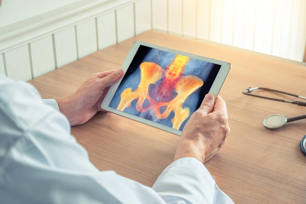 Lääkäri, jolla on digitaalinen tabletti, jossa on röntgenkuva lantiosta. Selkärangan ja lantion kipu
 - Valokuva, kuva