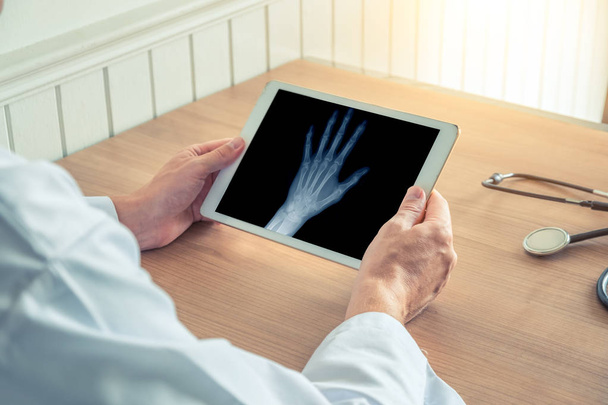 Doctor holding a digital tablet with x-ray of a left hand. Osteoarthritis concept - Photo, Image