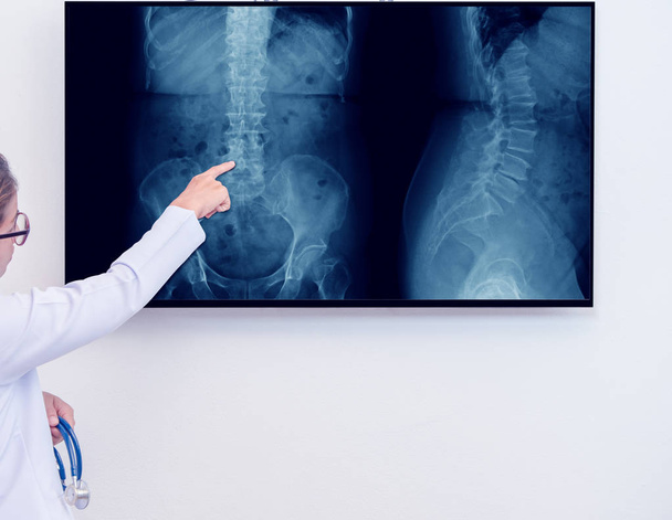 woman doctor pointing index finger to spine x-ray image - Φωτογραφία, εικόνα