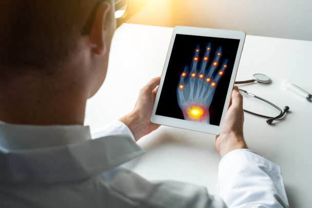 右手のX線写真を持つデジタルタブレットを持ち、指や手首の関節に痛みを感じている医師。変形性関節症の概念 - 写真・画像