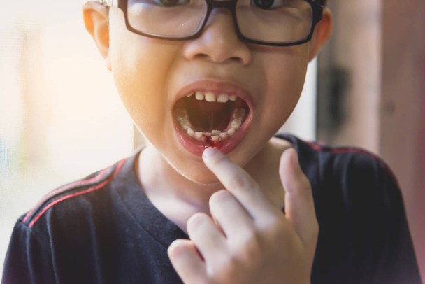 joven asiático chico suelto leche diente
 - Foto, Imagen