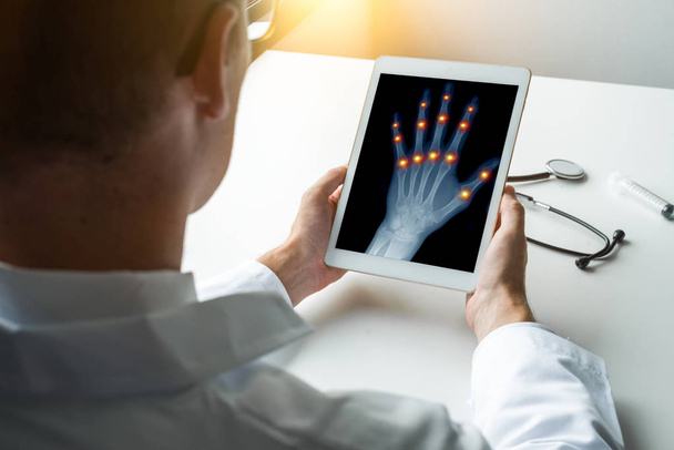 Doctor holding a digital tablet with x-ray of a left hand with pain on the joints of fingers. Osteoarthritis concept - Photo, Image