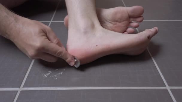 Homem removendo milho, calo de seus pés usando um arquivo de navalha, cuidados com a pele masculinos, doença de pele, infecção fúngica, tratamento da pele
 - Filmagem, Vídeo