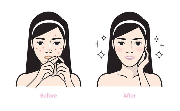 Étapes comment prendre soin du visage Illustration vectorielle
. - Vecteur, image