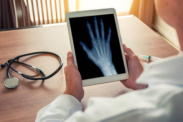 右手のX線でデジタルタブレットを持つ医師。机の上の聴診器と注射器。変形性関節症の概念 - 写真・画像