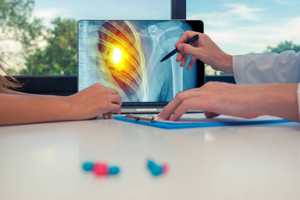 Médecin montrant une radiographie de la poitrine et des douleurs au cœur sur un ordinateur portable à une patiente. Concept de crise cardiaque. Pilules sur le bureau
 - Photo, image
