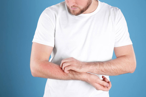 Man scratching forearm on color background, closeup. Allergy symptoms - Photo, Image
