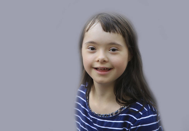 Aranyos Down-szindróma lány a szürke háttér - Fotó, kép