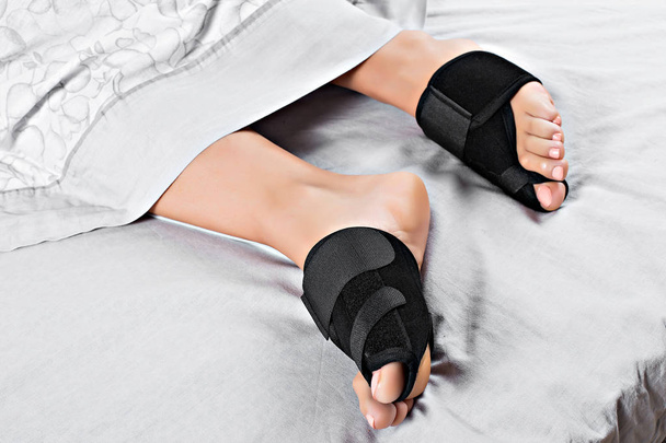 Woman foot bunion protection. Bunion corrector - Zdjęcie, obraz