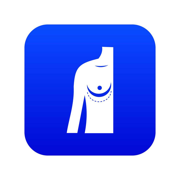 Breast implant surgery. icon digital blue - Вектор, зображення