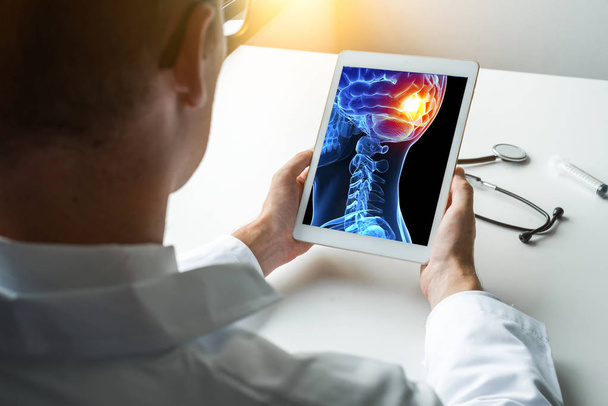 Doctor sosteniendo una tableta digital con rayos X de la cabeza 3D con dolor en la parte posterior del cerebro. concepto de migraña dolor de cabeza
 - Foto, imagen
