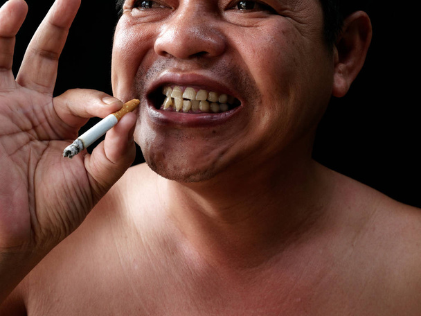 Un hombre sosteniendo cigarrillos. La nicotina destruye los dientes y las encías saludables. hace efecto Mancha amarilla, caries dental y mal aliento. mundo sin día de tobacoo
. - Foto, Imagen