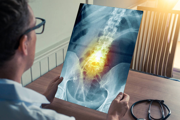 Γιατρός που κρατάει μια ακτινογραφία πόνου στη σπονδυλική στήλη στο ιατρικό γραφείο. - Φωτογραφία, εικόνα