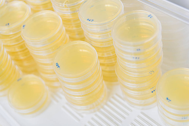 Pila de placas de Petri con cultivos en algas agar
. - Foto, imagen