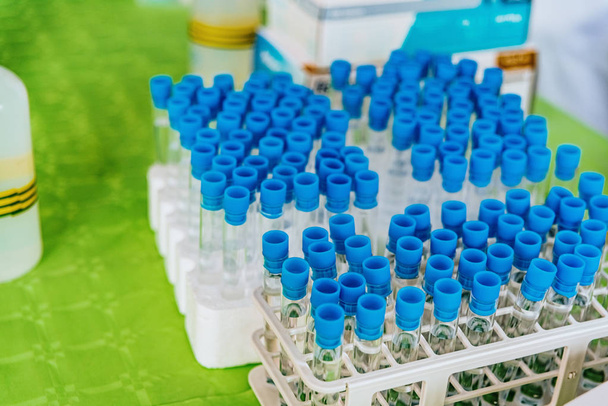 Muchos tubos de ensayo con enchufes azules en un estante lleno de exp científica
 - Foto, imagen