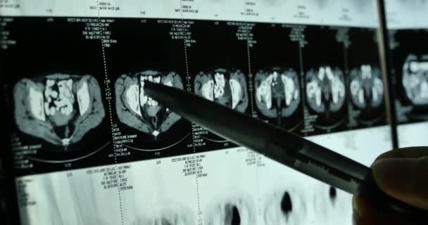 4k Врачи изучают рентгеновскую пленку мозга черепа для анализа.
. - Кадры, видео