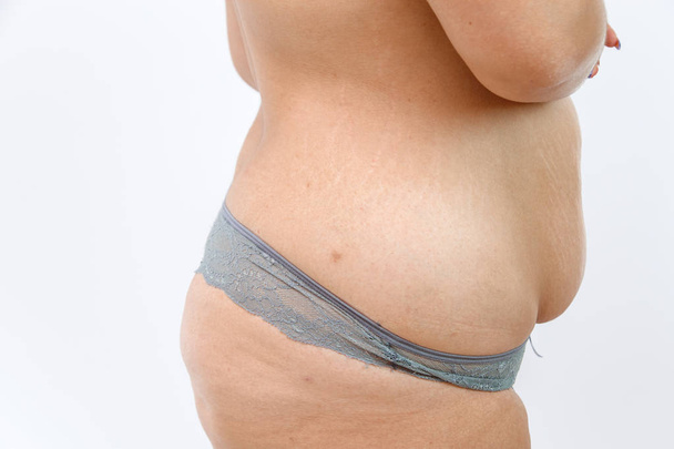 barriga grande e celulite pernas gordas de mulher sobrecarregada isolado
  - Foto, Imagem