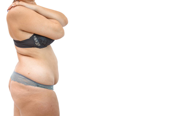 nuoren naisen ruumis alusvaatteissa raskausarpia ja rakkautta
 - Valokuva, kuva