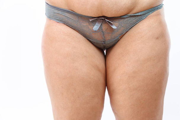 孤立した太りすぎの女性の大きな腹とセルライト脂肪脚  - 写真・画像